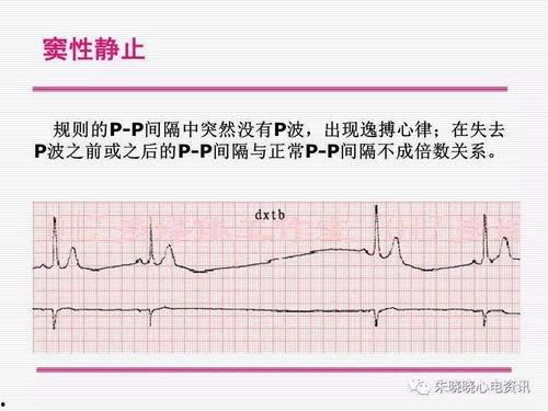 上海心电图视频吃瓜,揭秘瓜农的“心”声